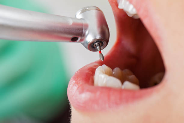 Best Urgent Dental Care for Toothache in Camdenton, MO